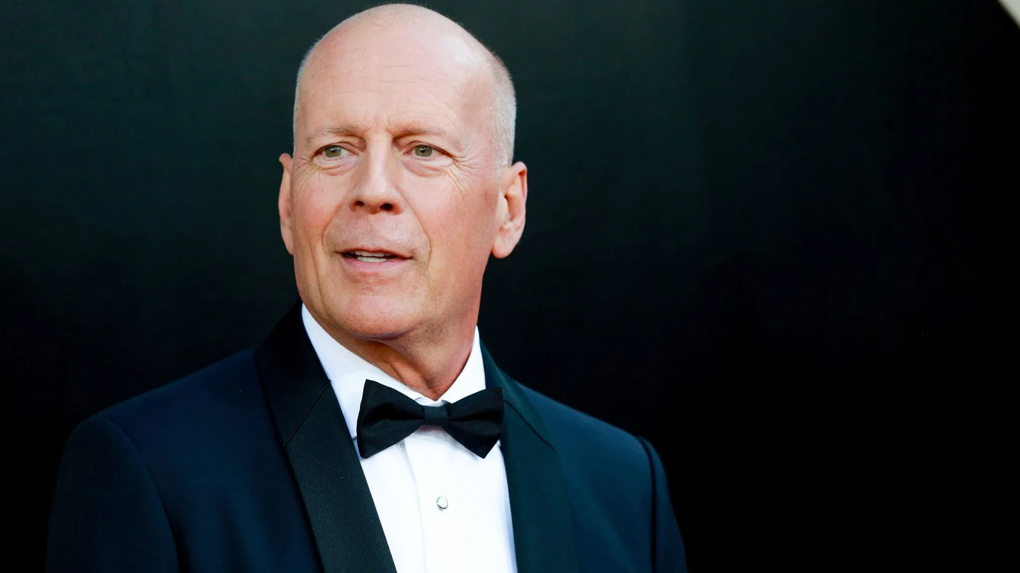 Bruce Willis was diagnosed with frontotemporal dementia